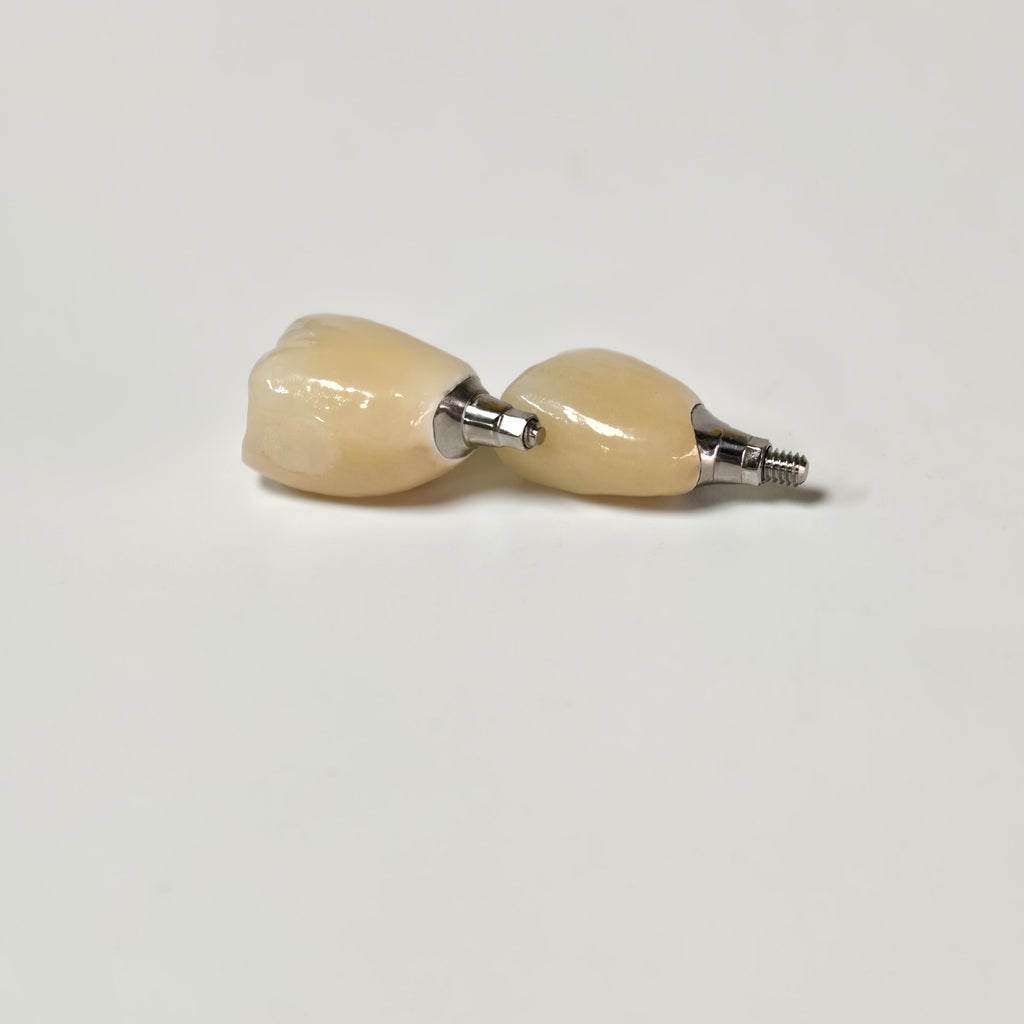 Zirconia Crowns With Screw Retained