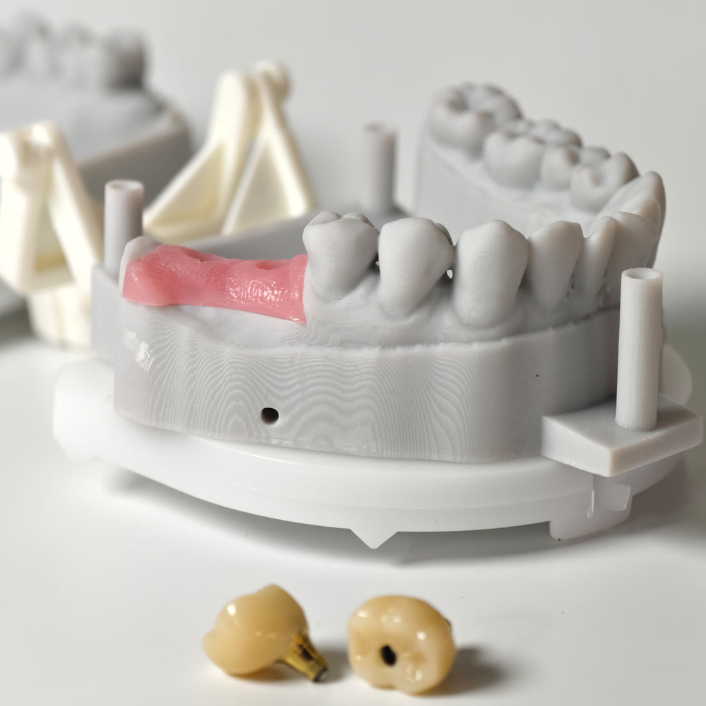 Zirconia Crowns With Screw Retained