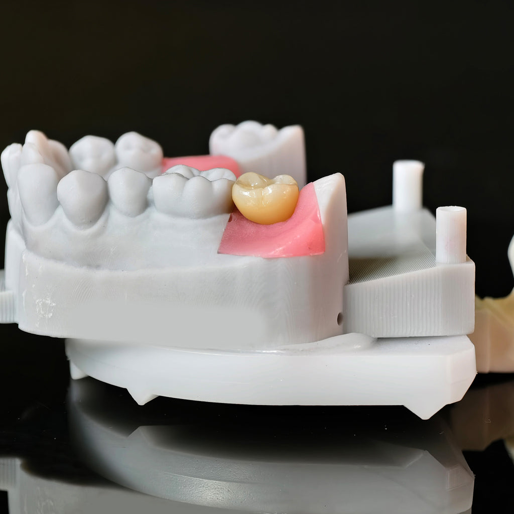 Zirconia Crowns With Screw Retained