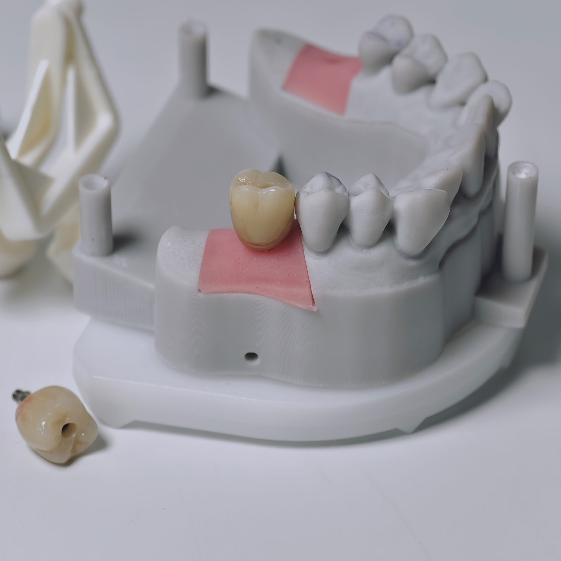 Zirconia Crowns With Screw Retained