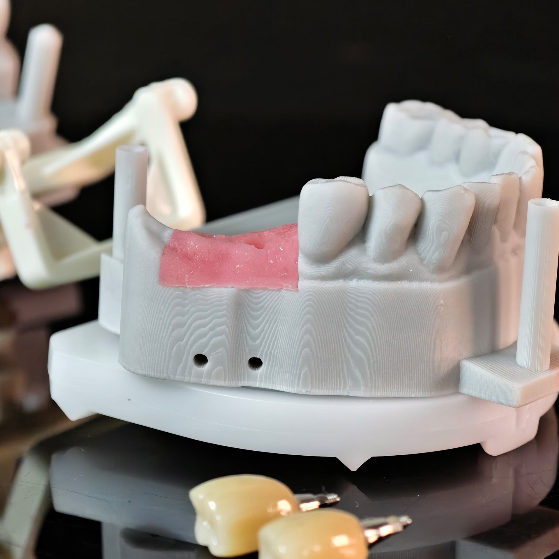 Zirconia Crowns With Screw Retained