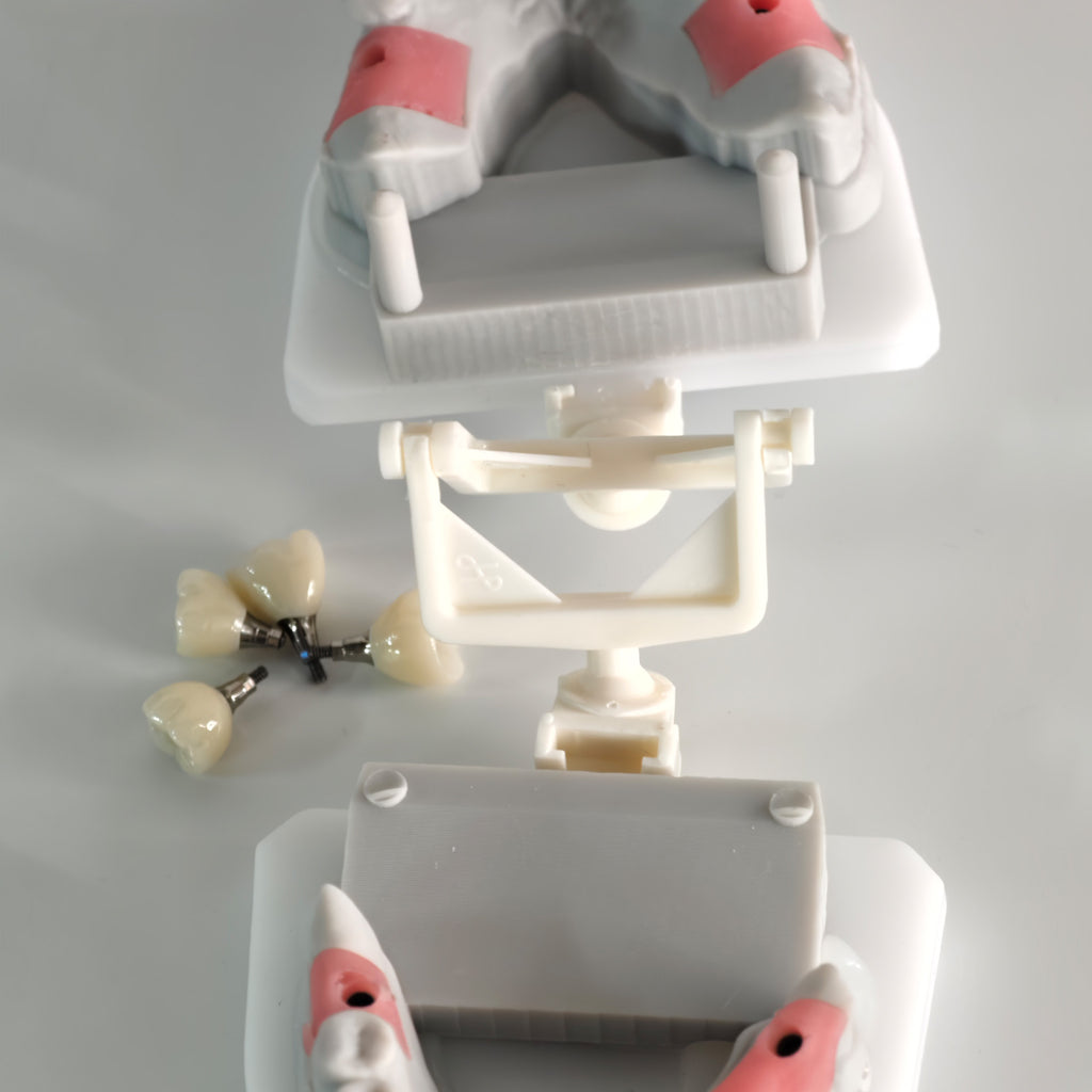 Zirconia Crowns With Screw Retained