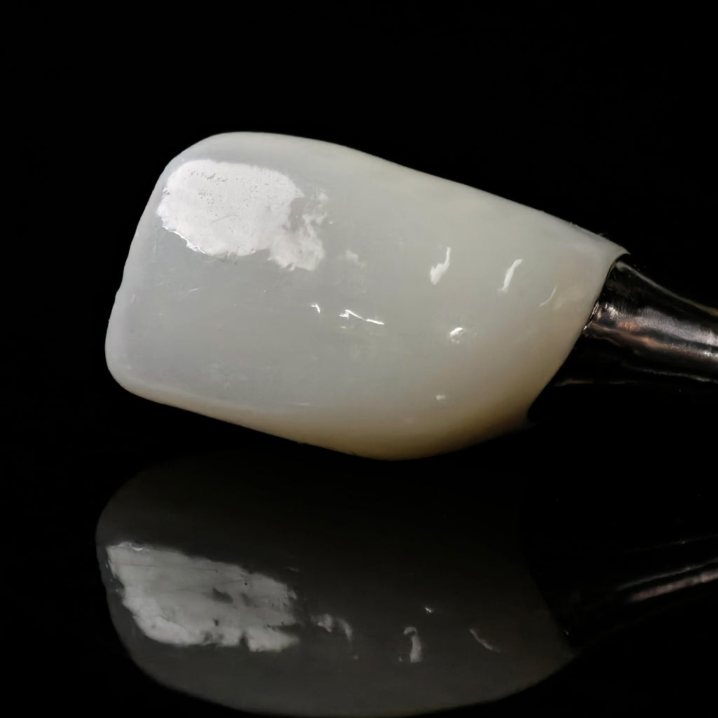 Zirconia Crown With Screw Retained