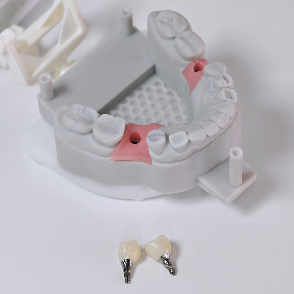 Zirconia Crown With Screw Retained