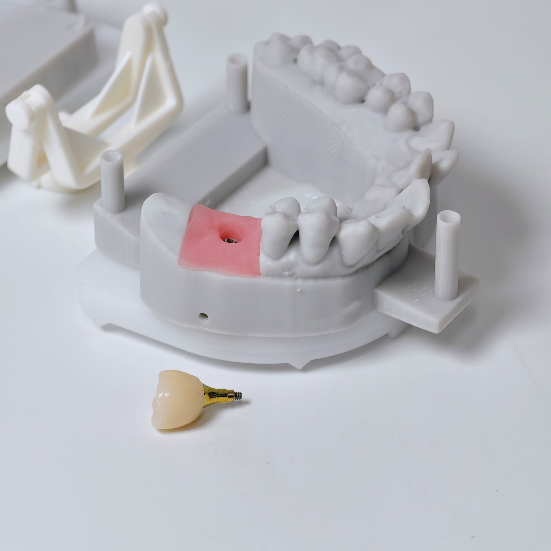 Zirconia Crown With Screw Retained
