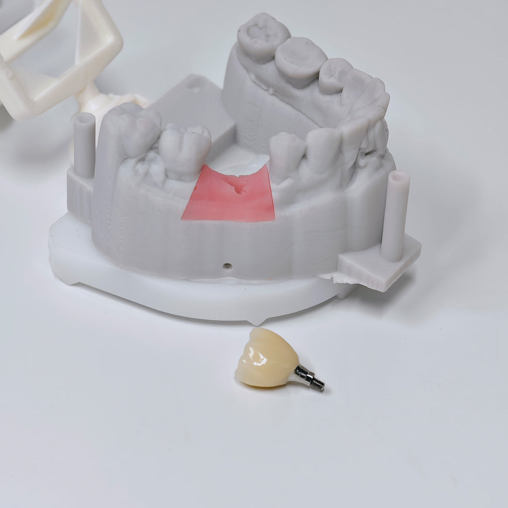 Zirconia Crown With Screw Retained
