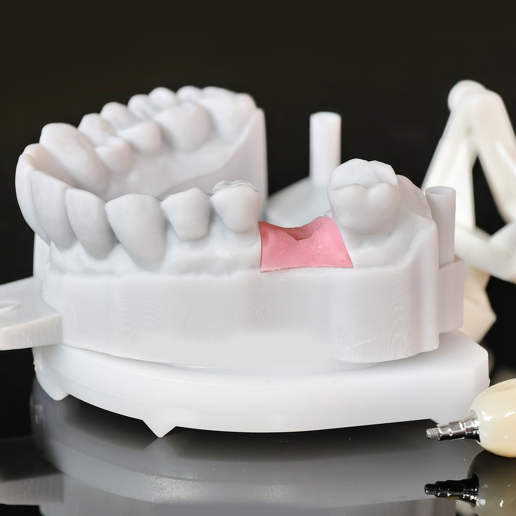 Zirconia Crown With Screw Retained