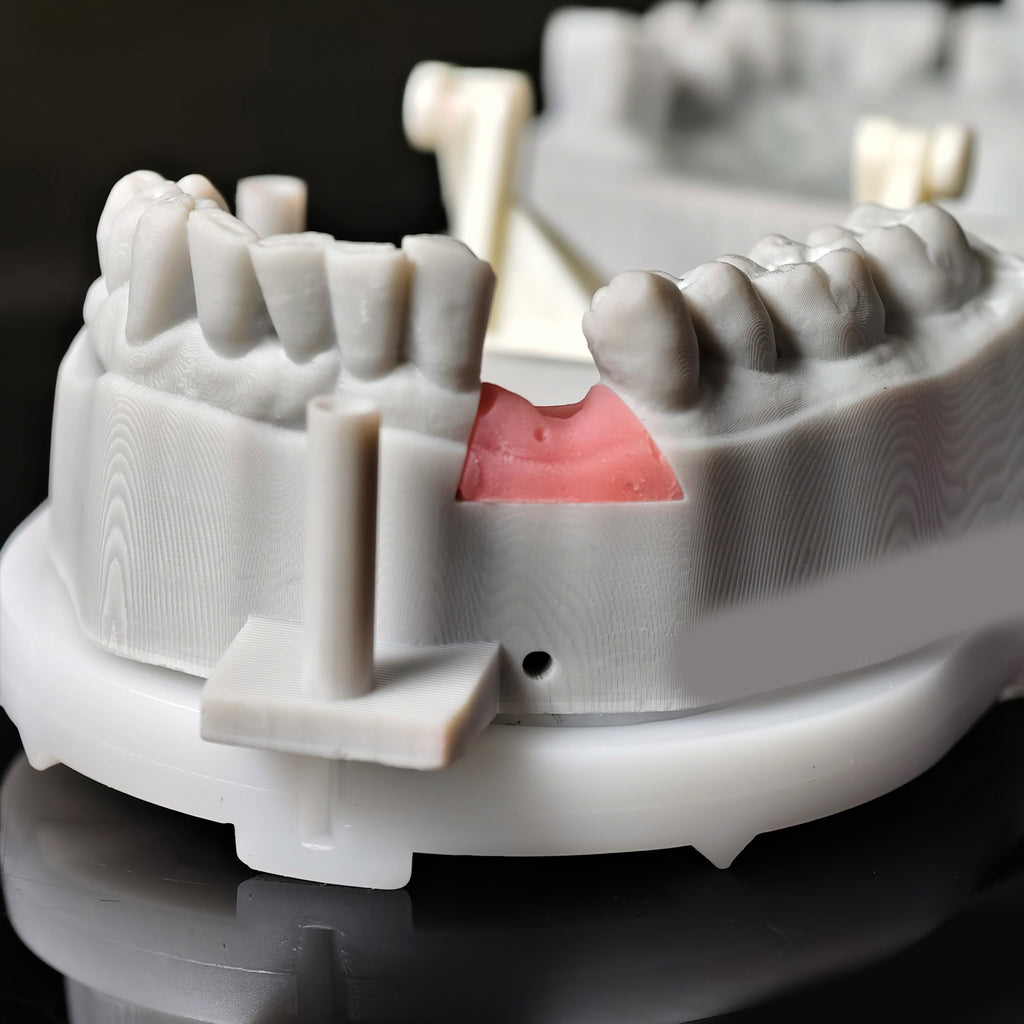 Zirconia Crown With Screw Retained
