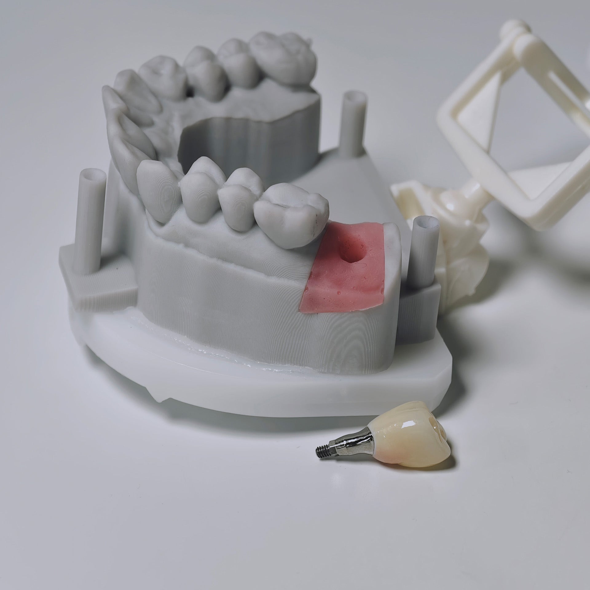 Zirconia Crown With Screw Retained
