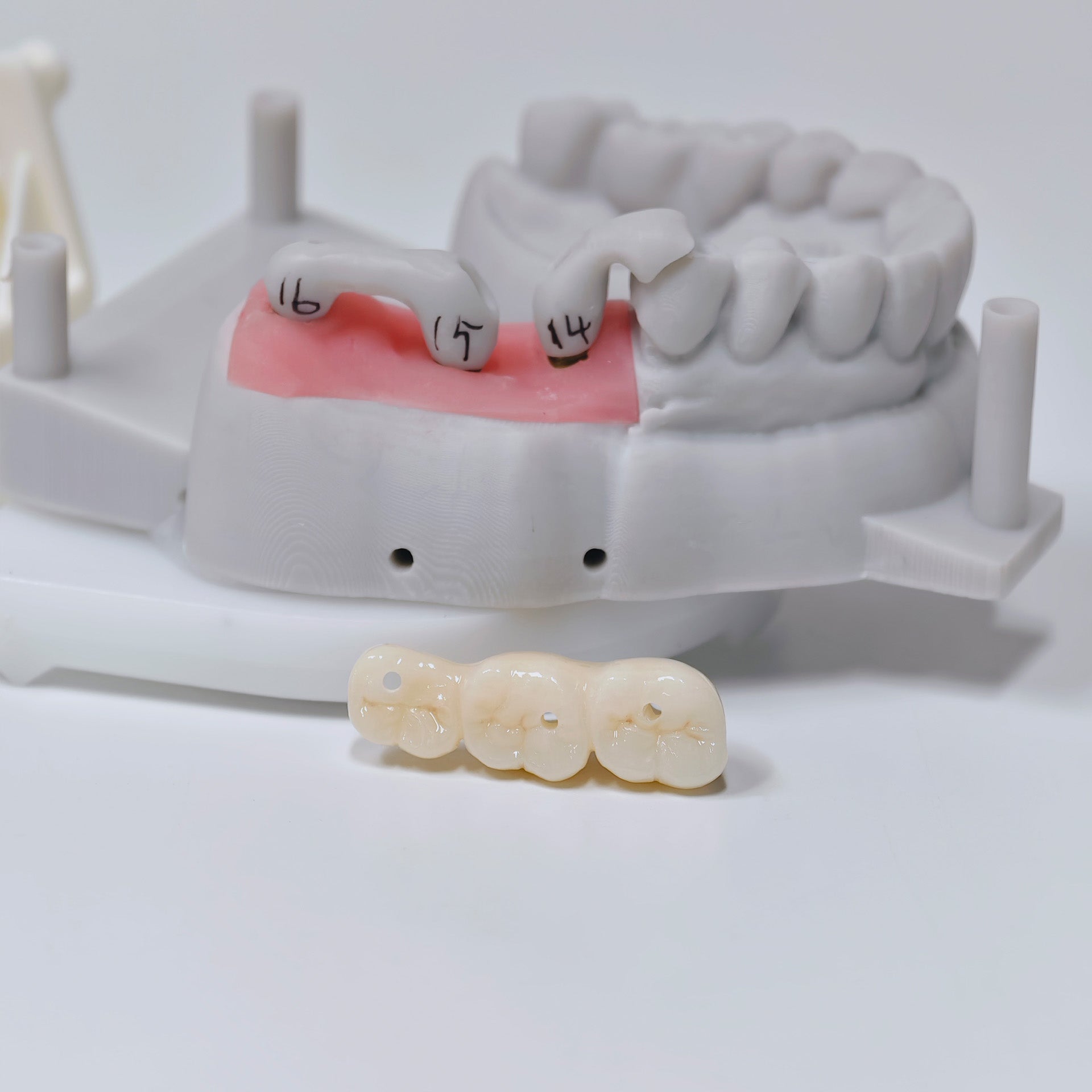Zirconia Implant Bridge Screwmentable Dental Crown
