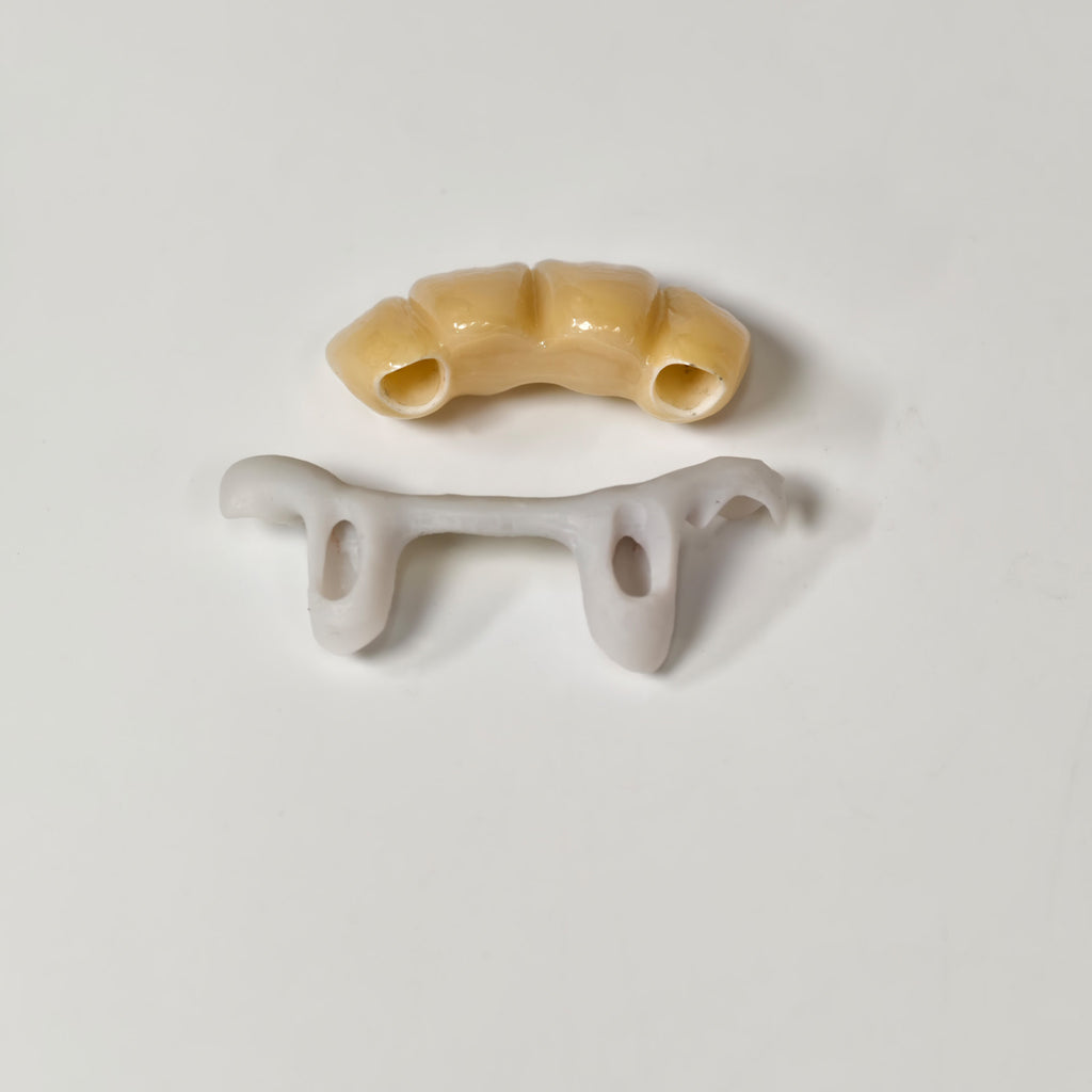 Zirconia Implant Bridge Screwmentable Dental Crown