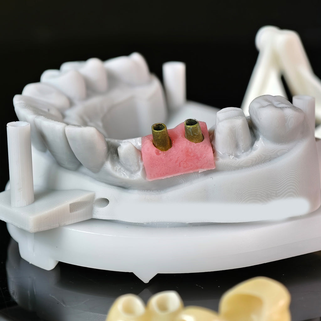 Zirconia Implant Bridge Screwmentable Dental Crown