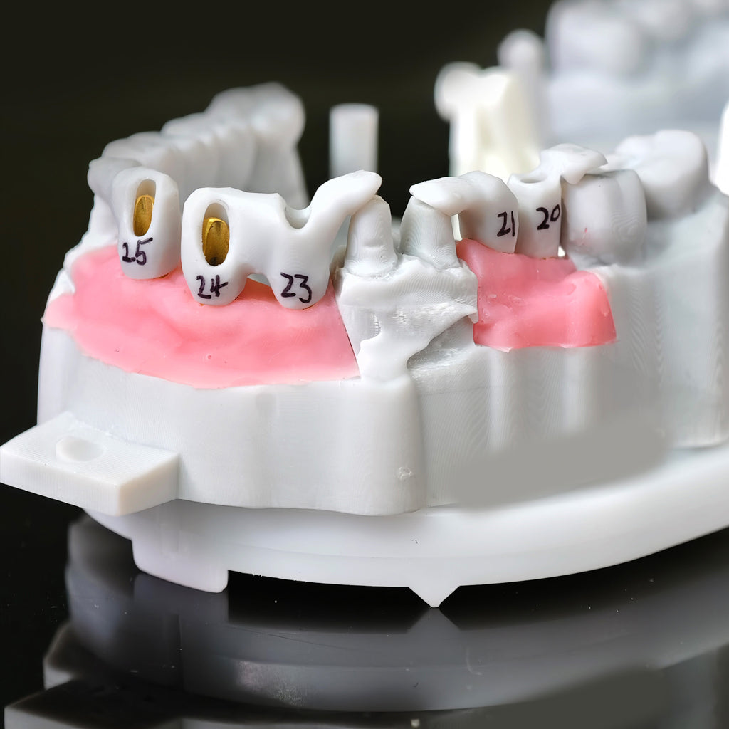 Zirconia Implant Bridge Screwmentable Dental Crown