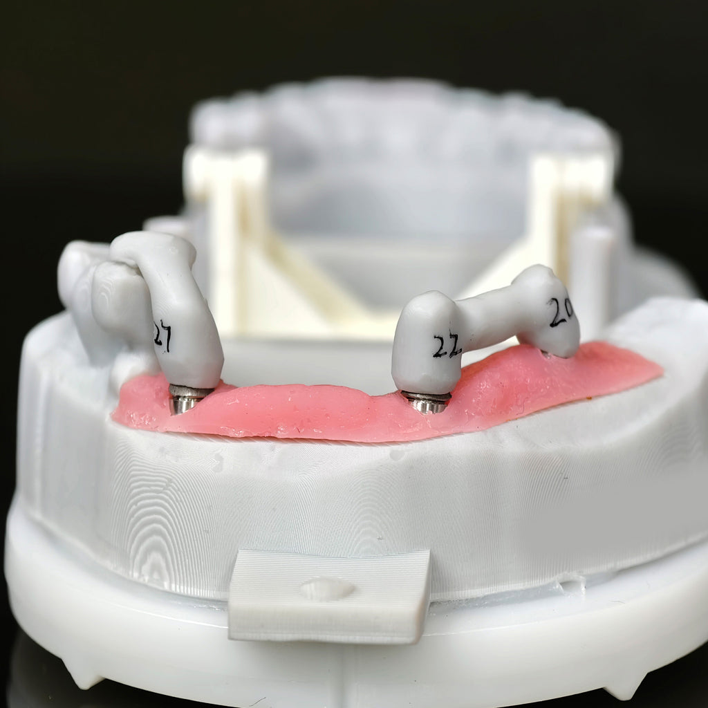 Zirconia Implant Bridge Screwmentable Dental Crown