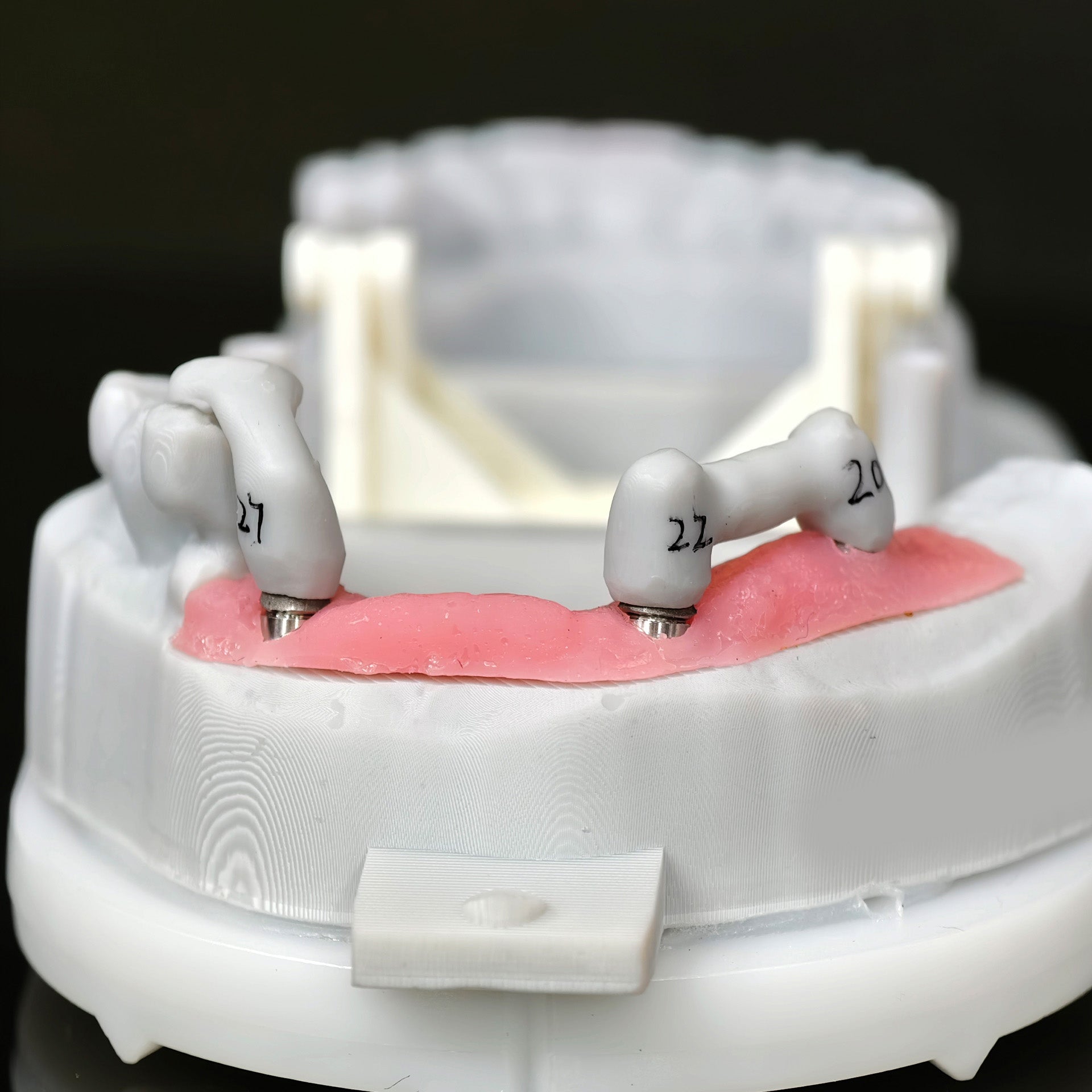 Zirconia Implant Bridge Screwmentable Dental Crown
