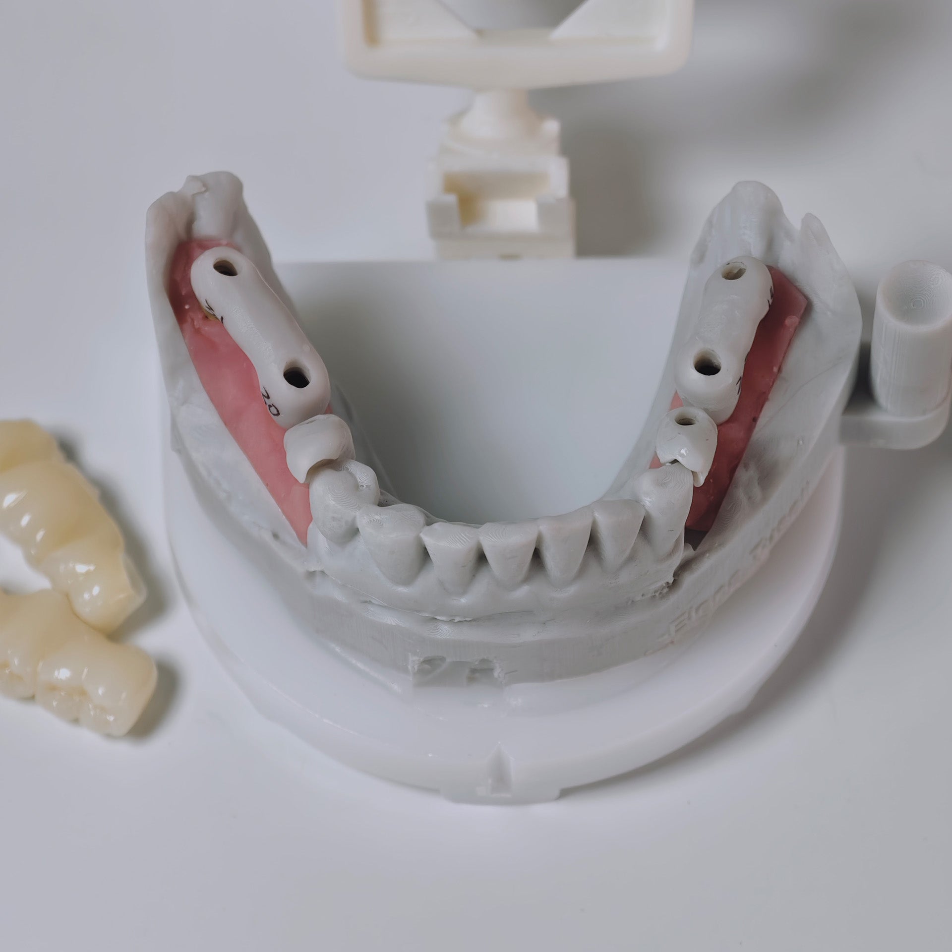 Zirconia Implant Bridges Screwmentable Dental Crown