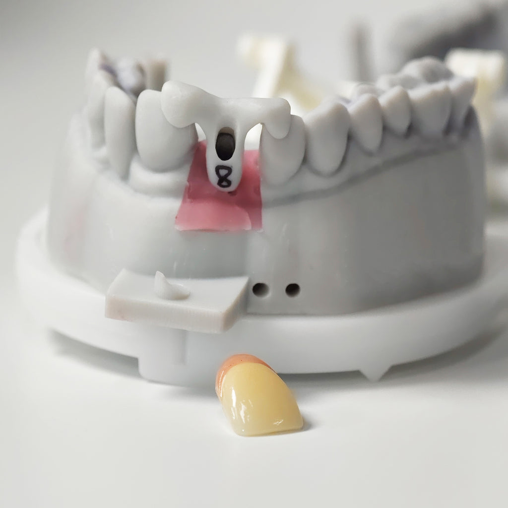 Zirconia Implant Crown Screwmentable Dental Crown