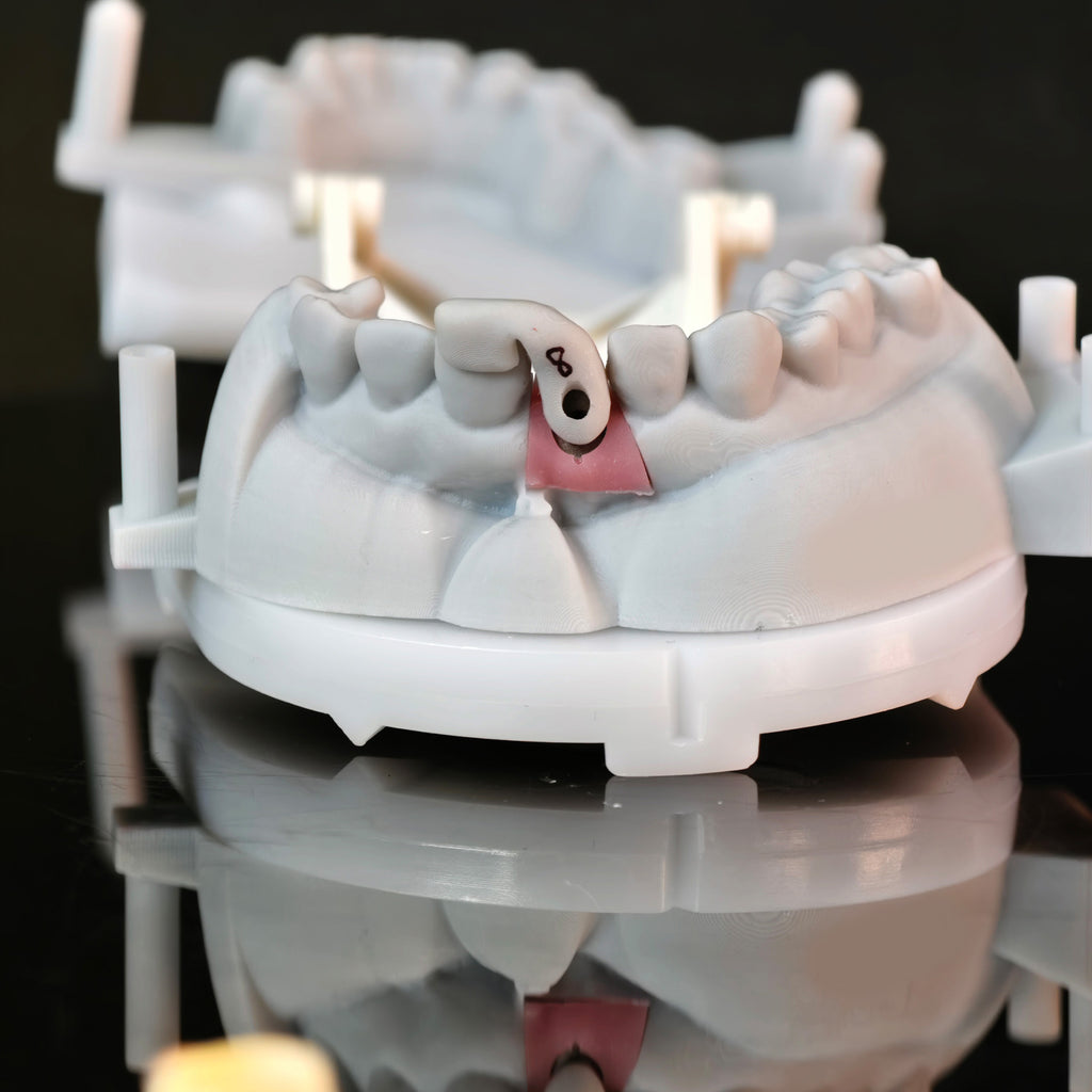 Zirconia Implant Crown Screwmentable Dental Crown