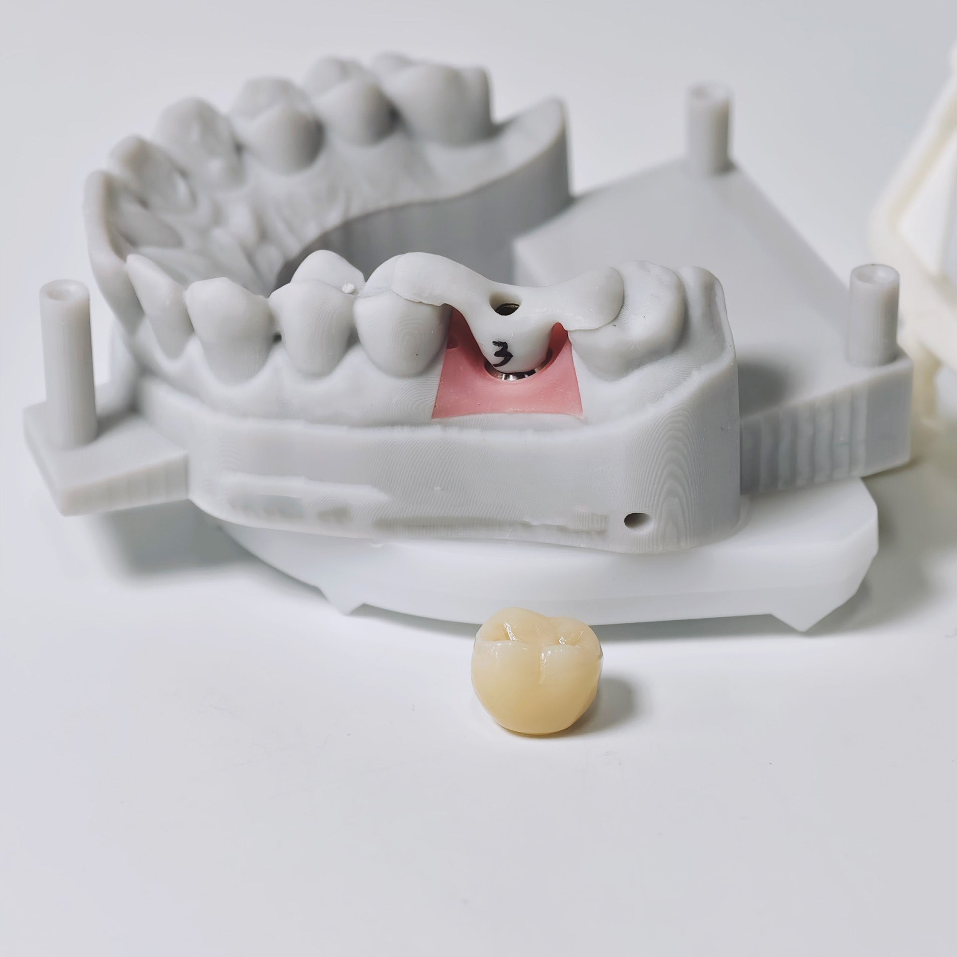 Zirconia Implant Crown Screwmentable Dental Crown