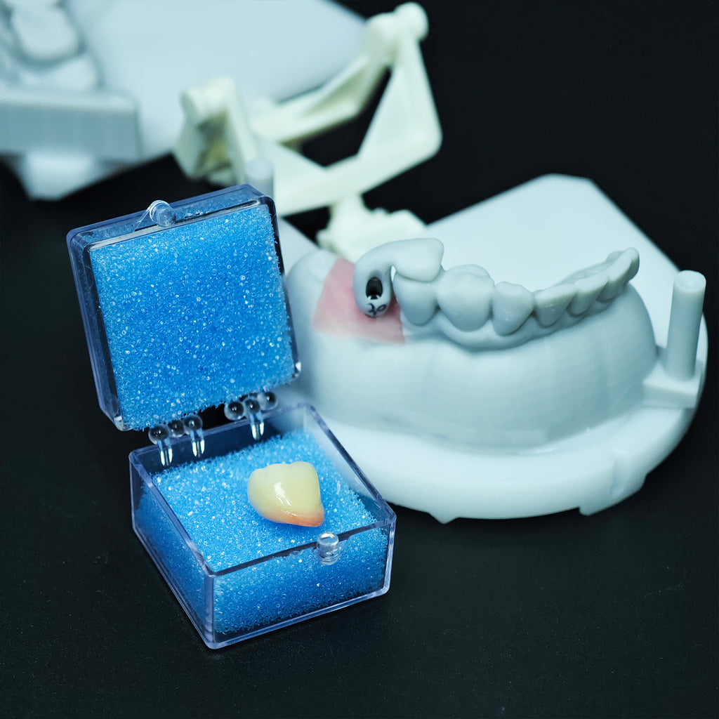 Zirconia Implant Crown Screwmentable Dental Crown