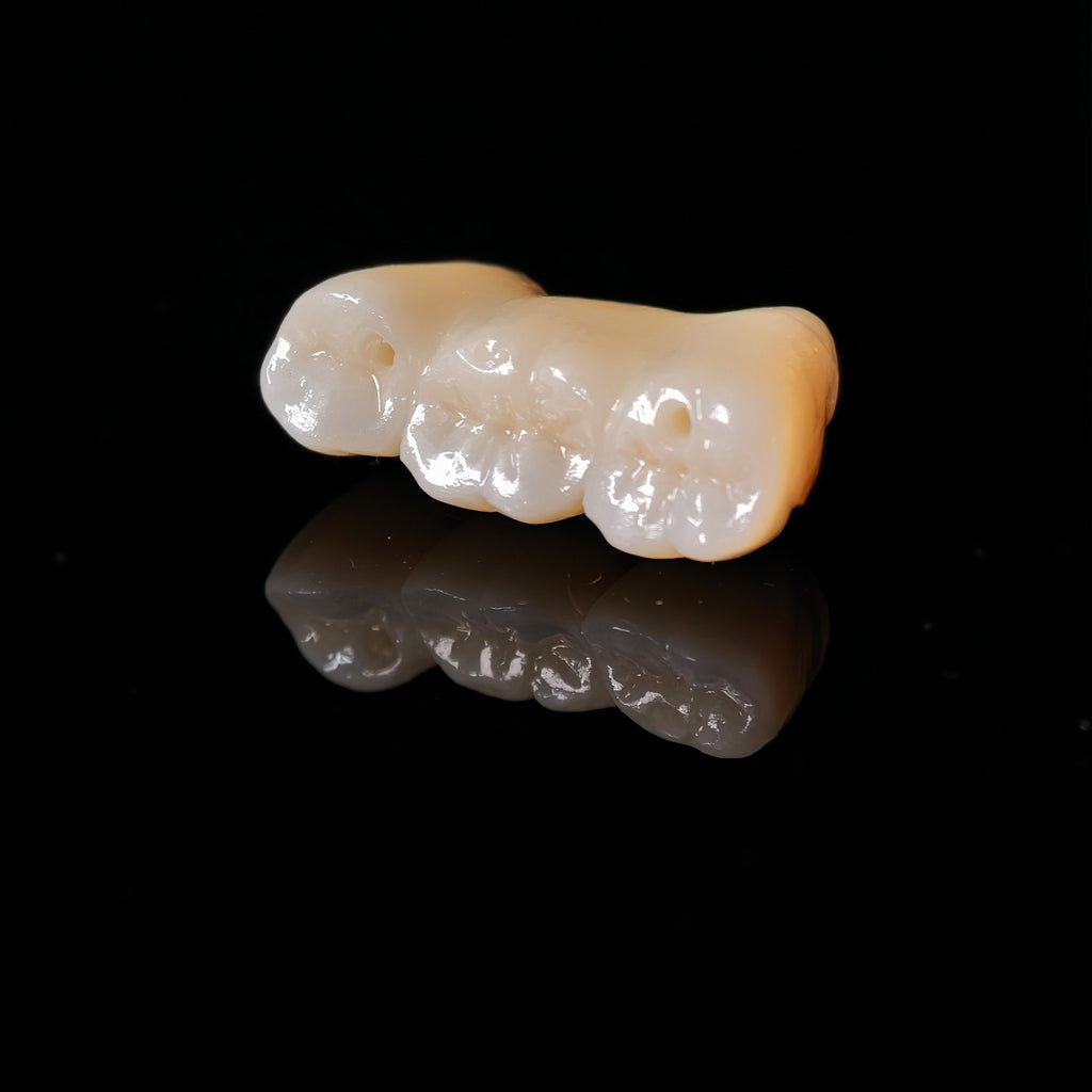 Zirconia Implant Crown Screwmentable Dental Crown