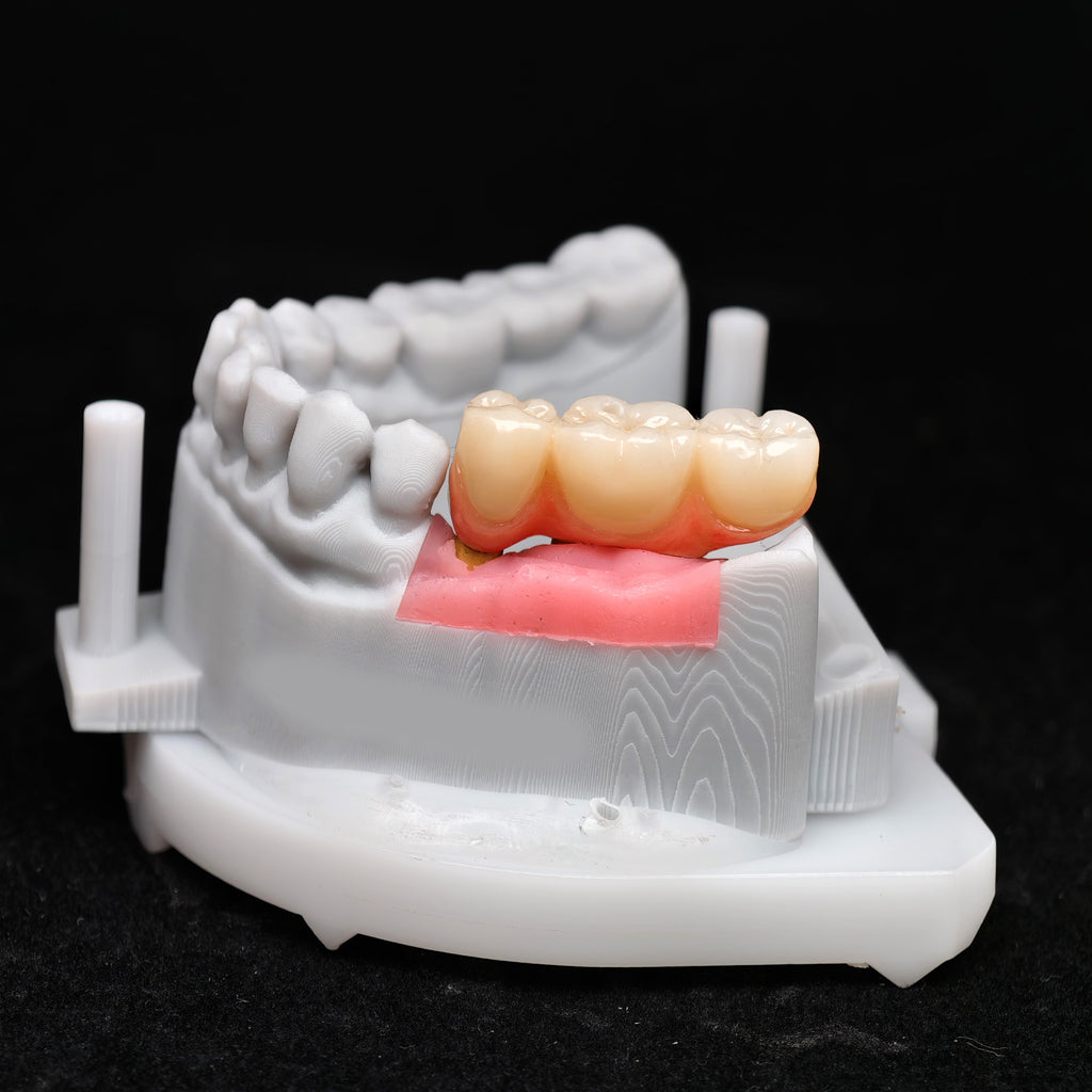 Zirconia Implant Crown Screwmentable Dental Crown