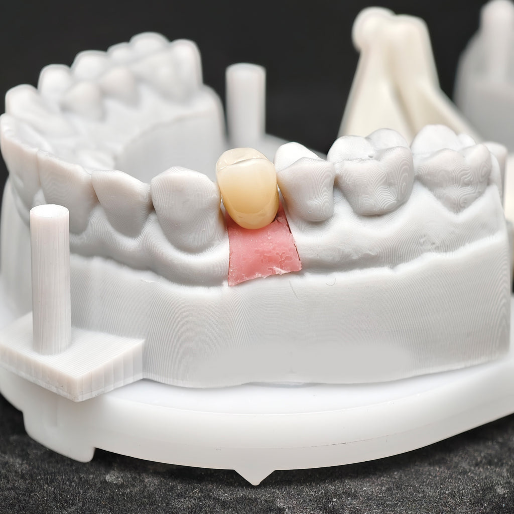 Zirconia Implant Crown Screwmentable Dental Crown