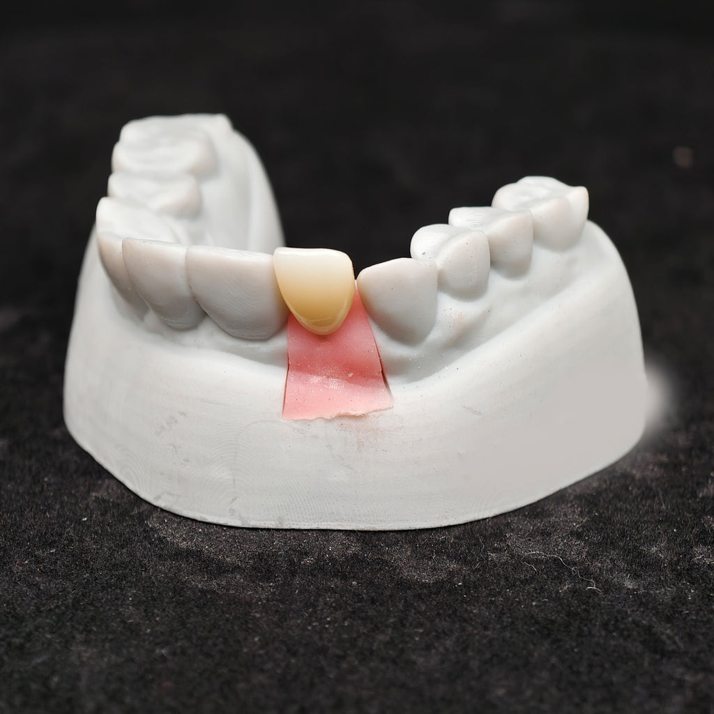 Zirconia Implant Crown Screwmentable Dental Crown
