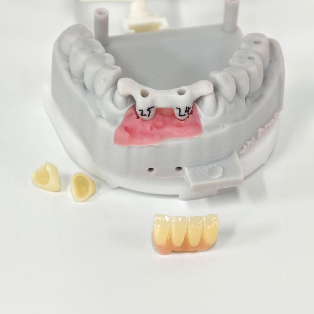 Zirconia Implant Crown And Bridge Screwmentable Dental Crown
