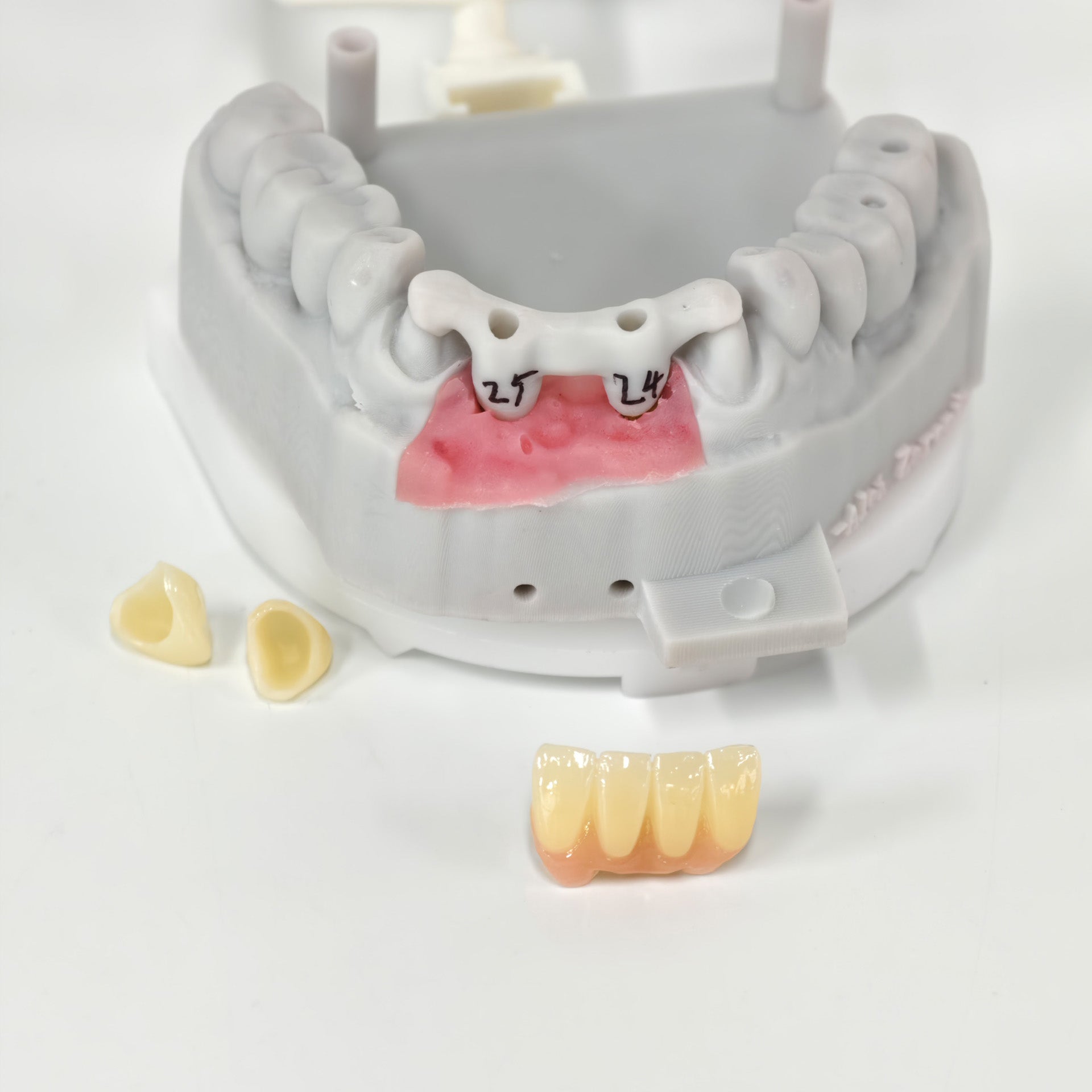 Zirconia Implant Crown And Bridge Screwmentable Dental Crown
