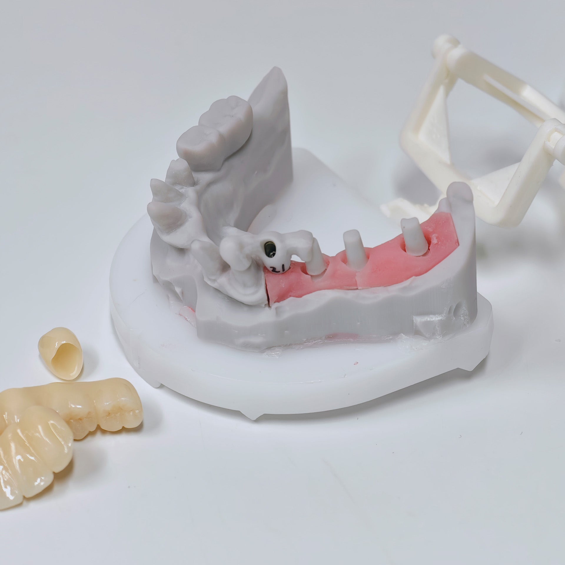 Zirconia Implant Crown And Bridges Screwmentable Dental Crown