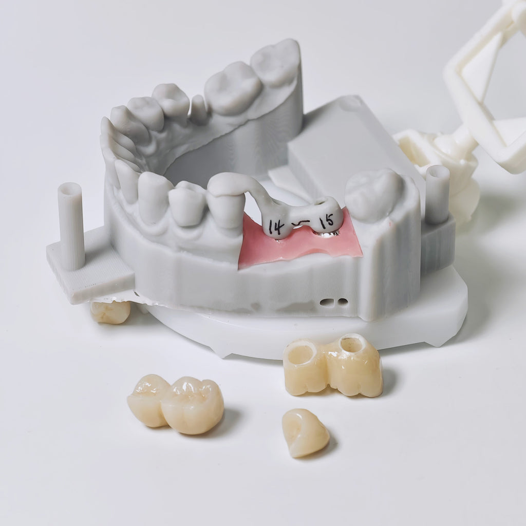 Zirconia Implant Crowns And Bridges Screwmentable Dental Crown