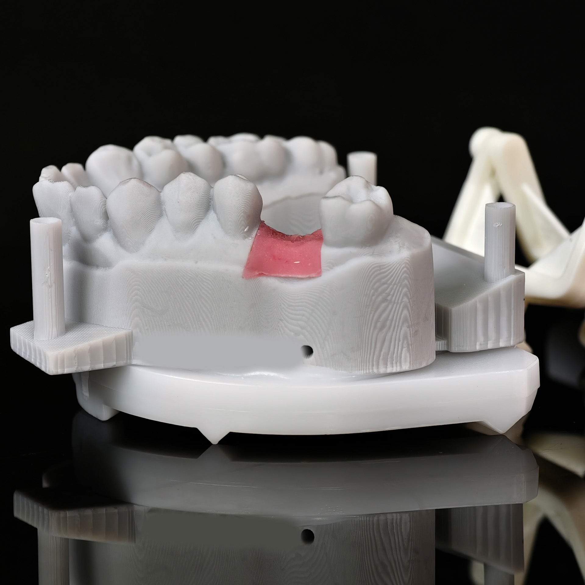 Zirconia Implant Crown With Gold Plating
