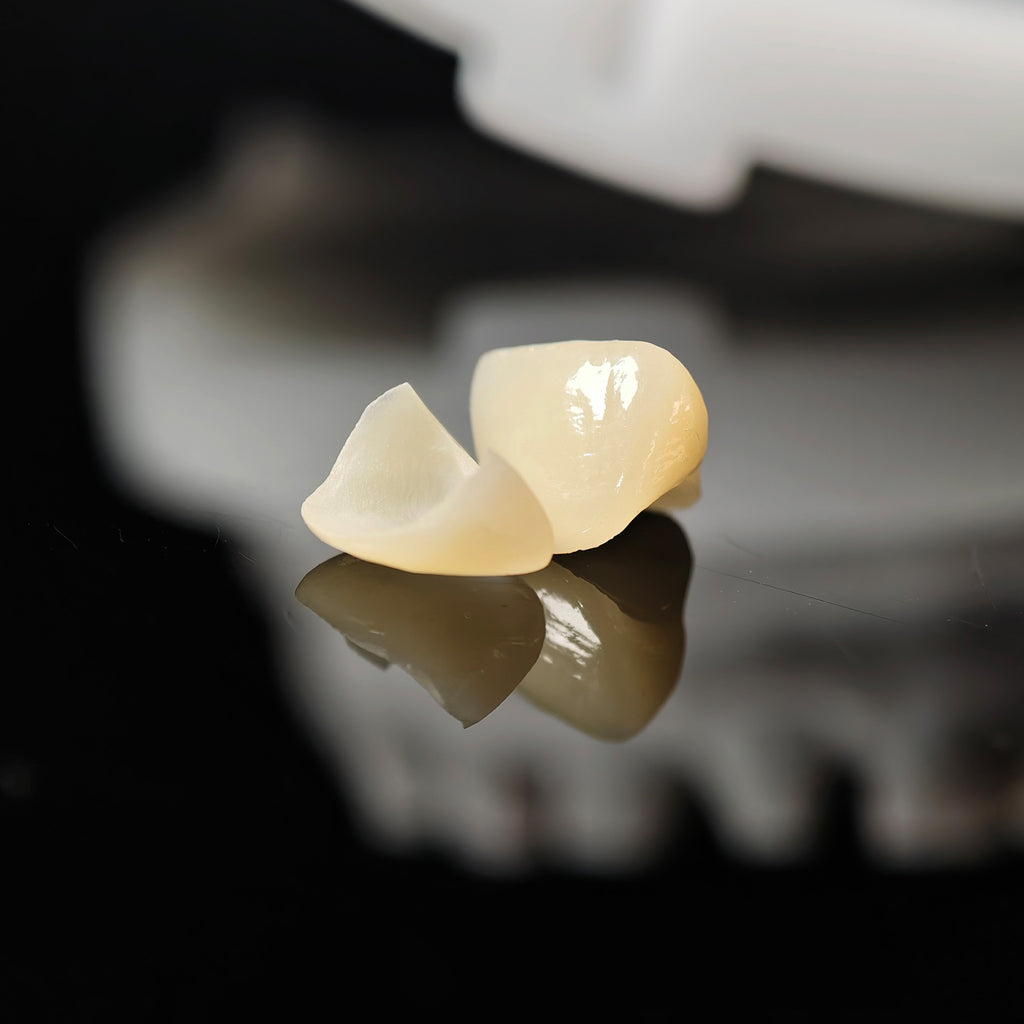 Zirconia Veneer. High Transparency/Translucent, Natural Shade
