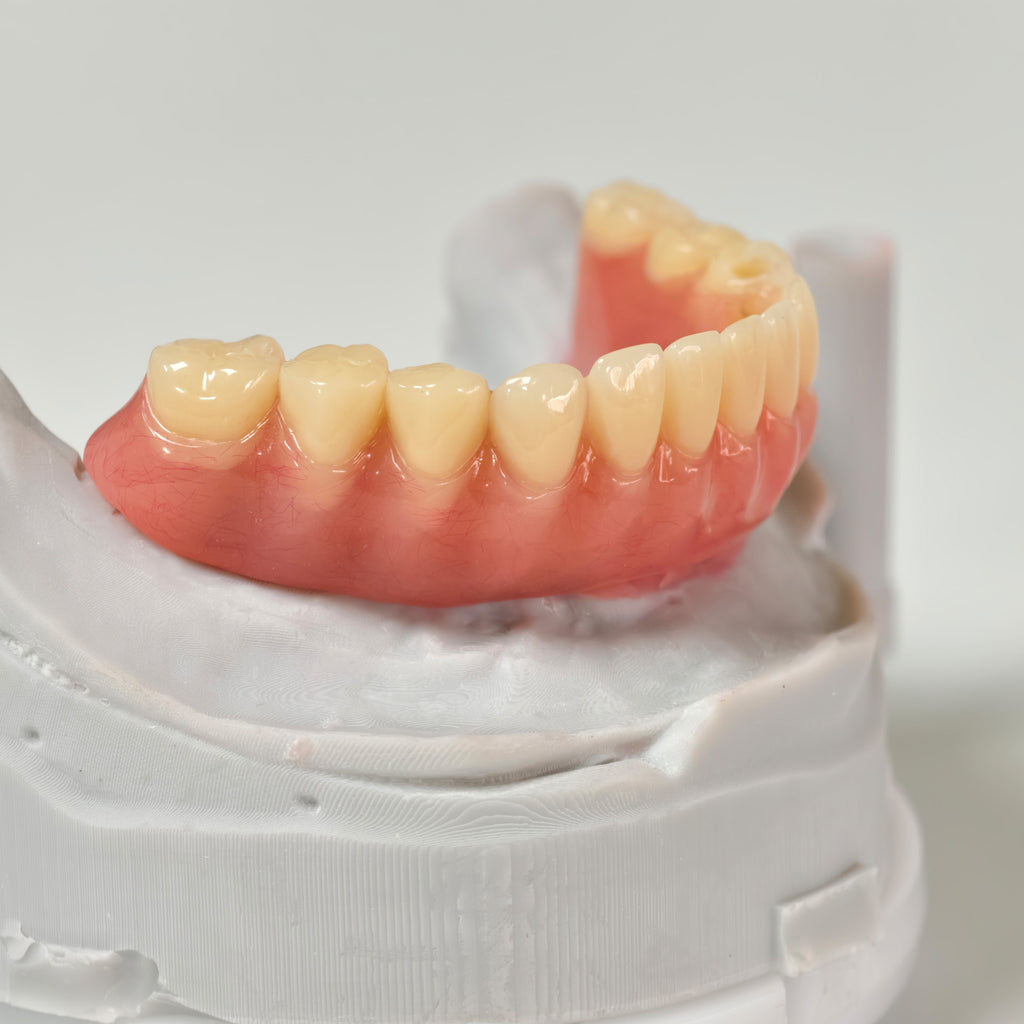 Acrylic Denture With Ti-Bar And Screw Retained