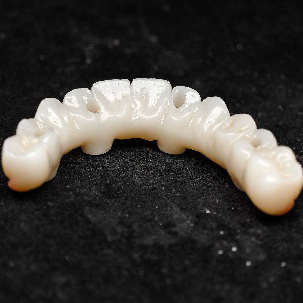 All On 4 Zirconia Bridge With Ti-Base Screw Retained Trying For Full Arch Restoration