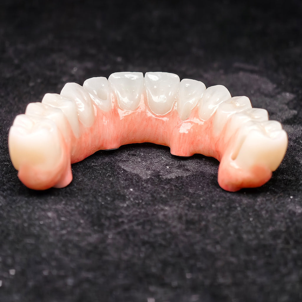 All On 4 Zirconia Bridge With Ti-Base Screw Retained Trying For Full Arch Restoration