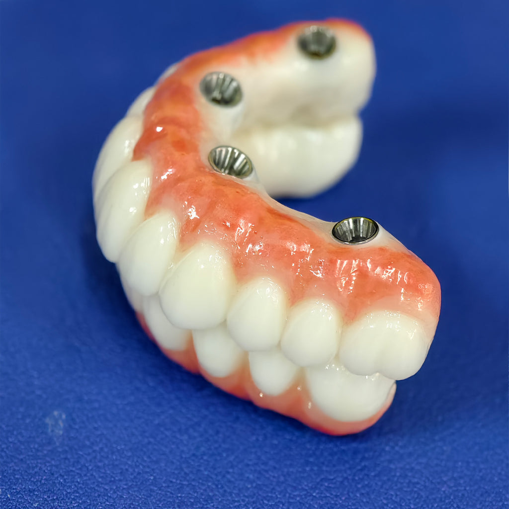 All On 4 Zirconia Bridge With Ti-Base Screw Retained Trying For Full Arch Restoration