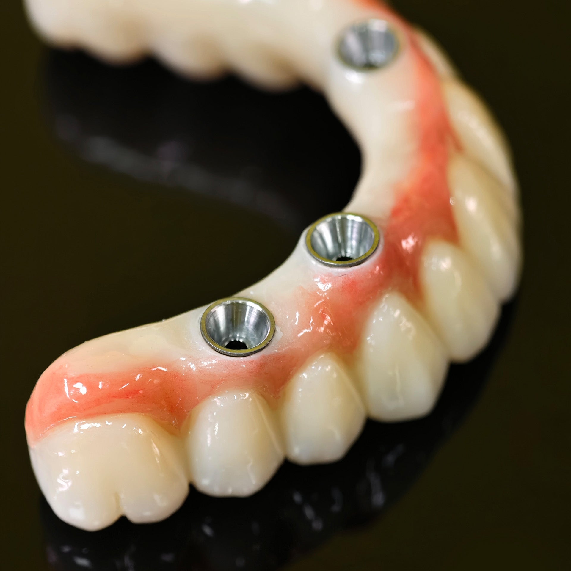 All On 5 Zirconia Bridge With Ti-Base Screw Retained Trying For Full Arch Restoration