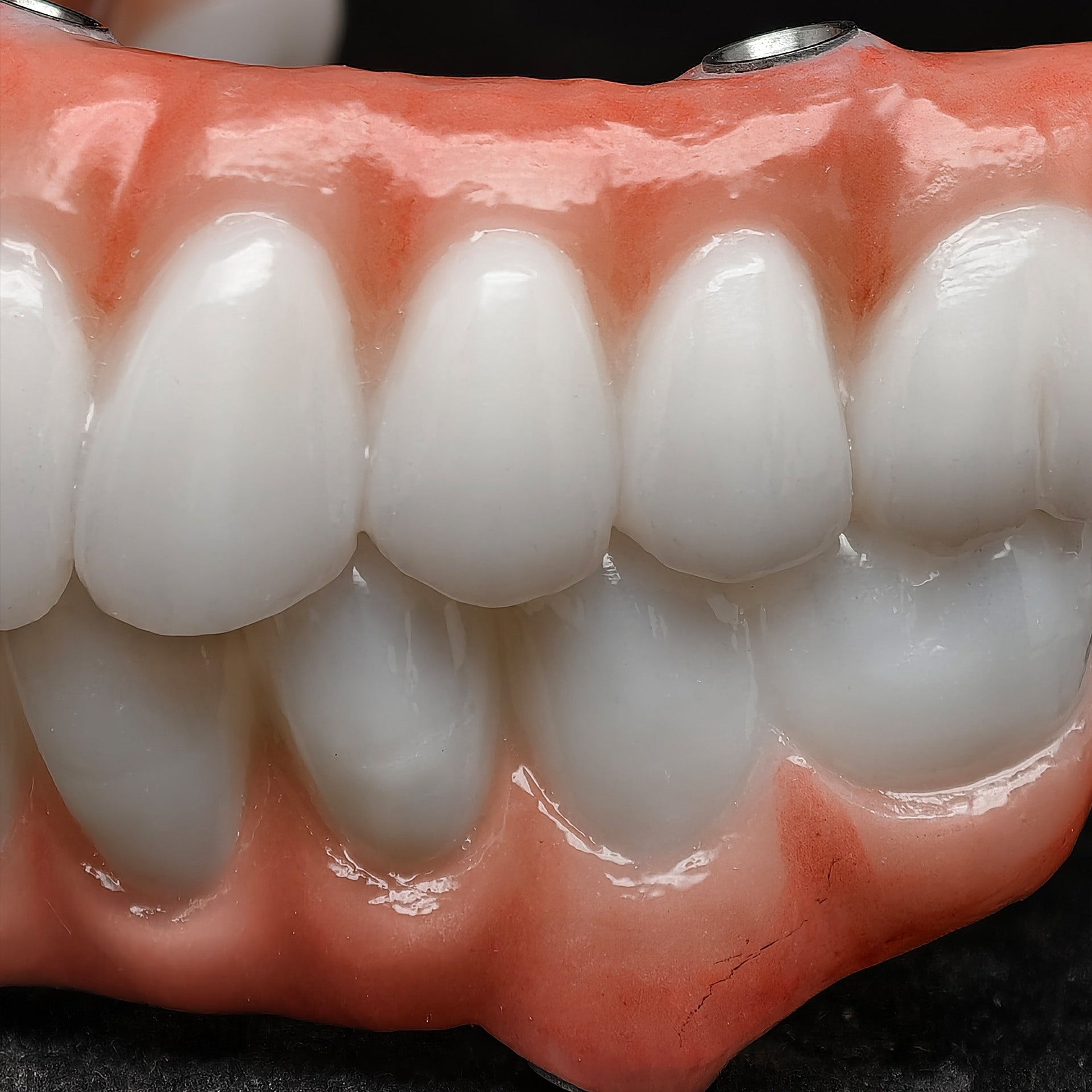 All On 5 Zirconia Bridge With Ti-Base Screw Retained Trying For Full Arch Restoration