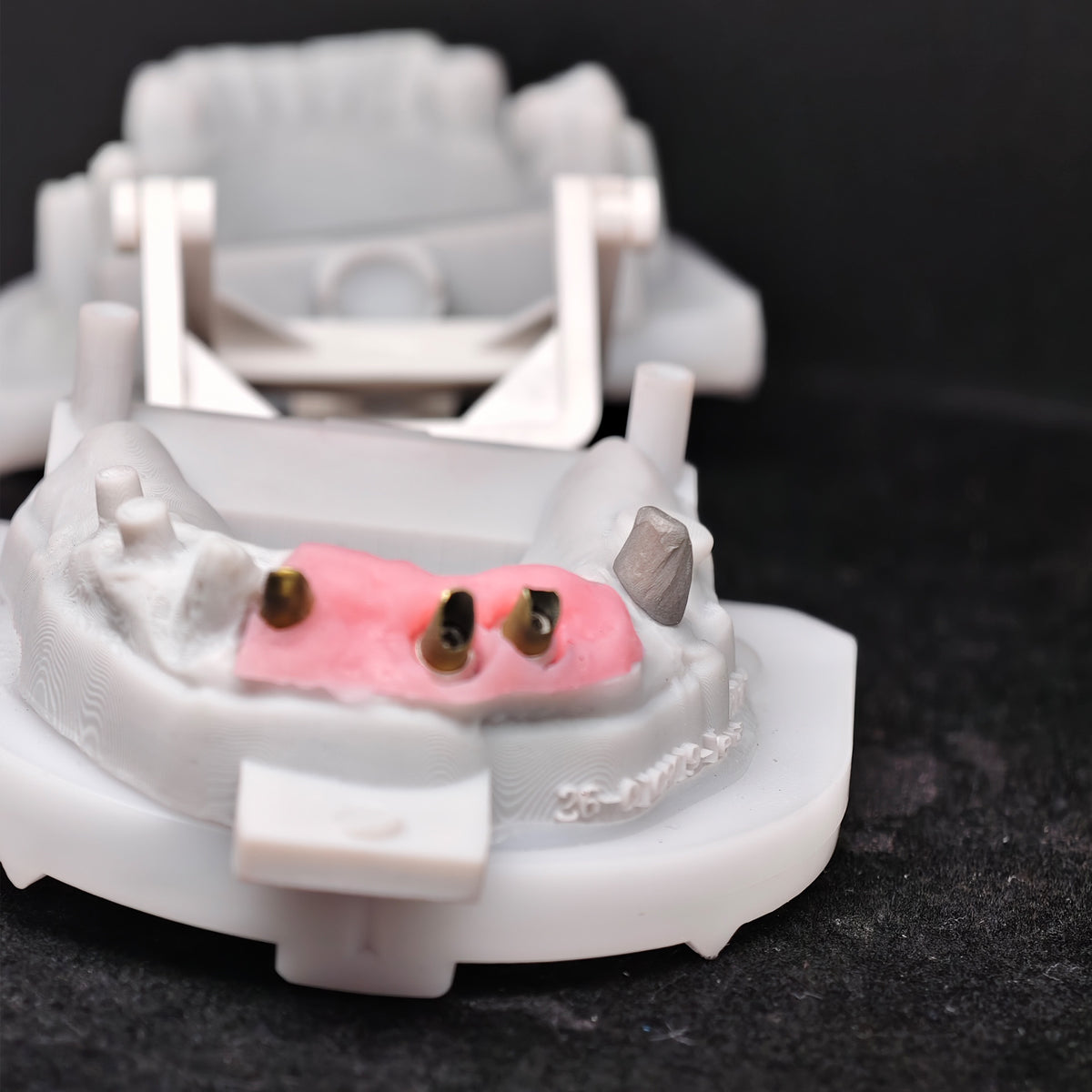 Custom Abutment With Zirconia Crown And Bridge