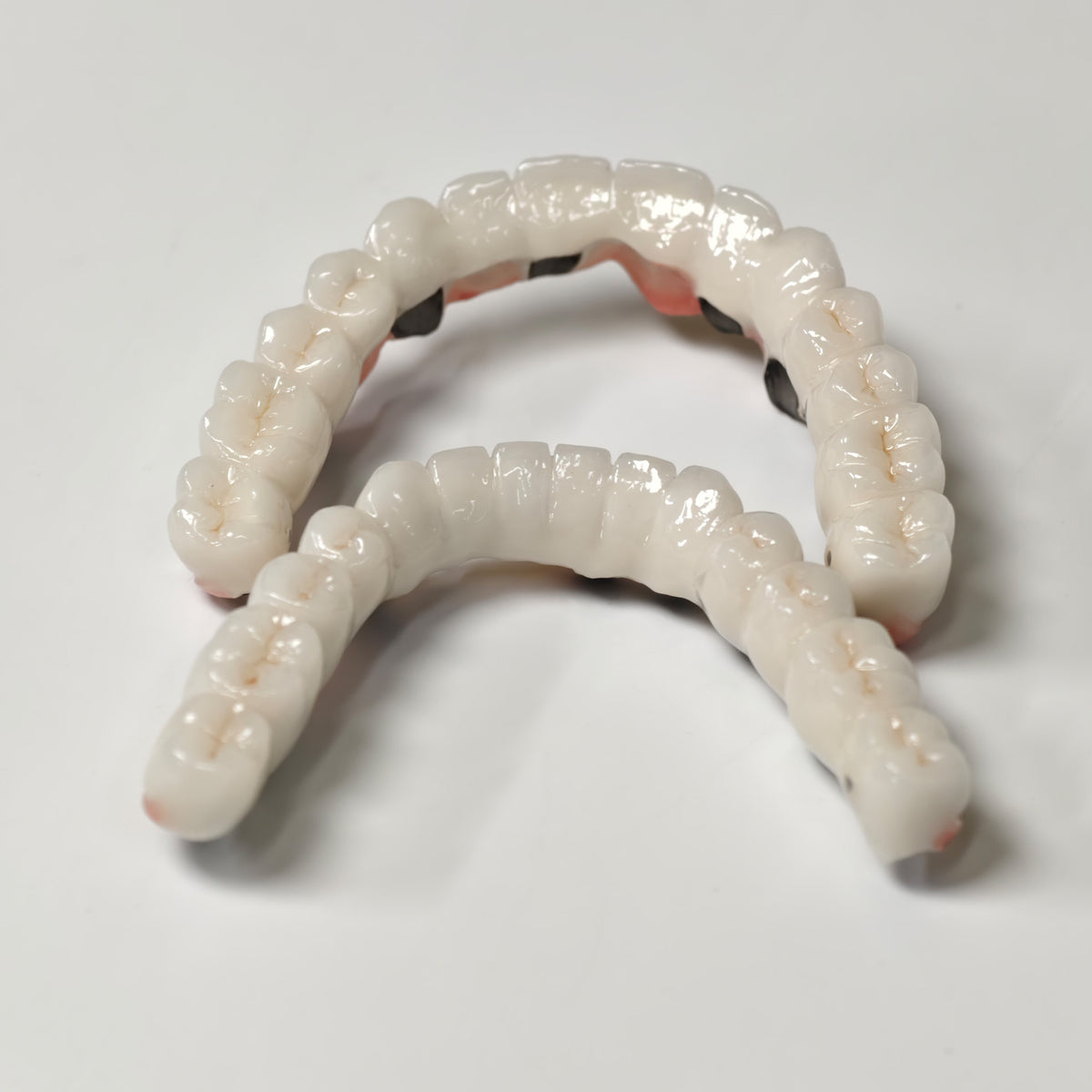 Full-Arch PFM Bridge With Screw Retained