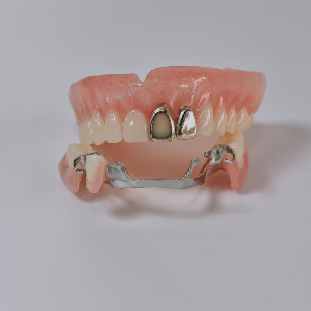 Full-Mouth Acrylic Denture