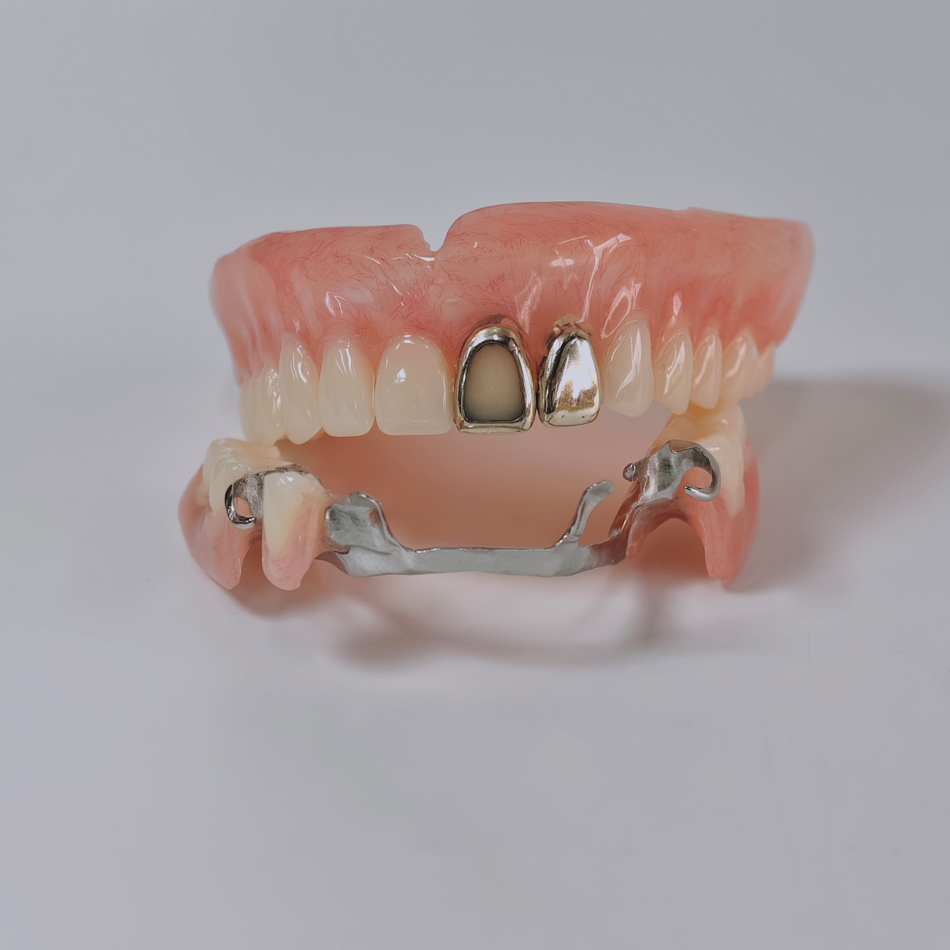 Full-Mouth Acrylic Denture