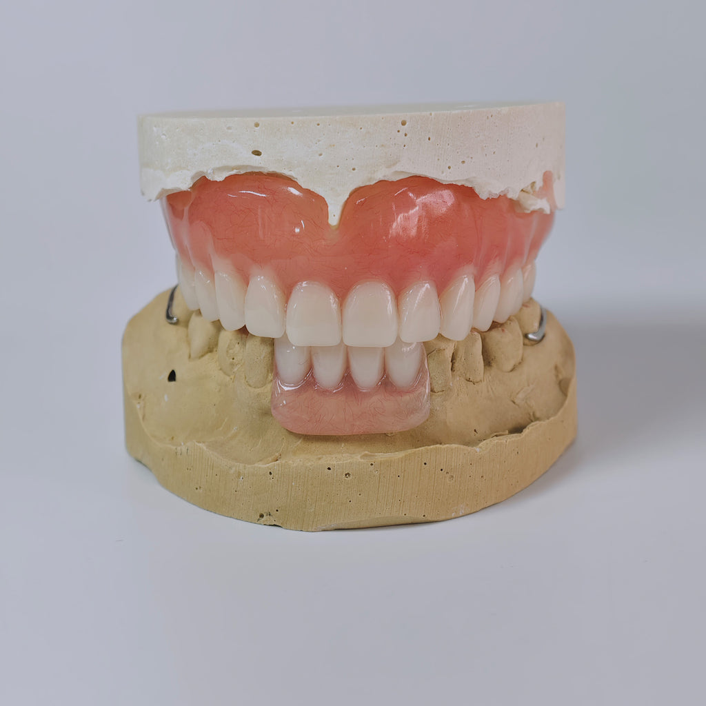 Full-Mouth Acrylic Denture