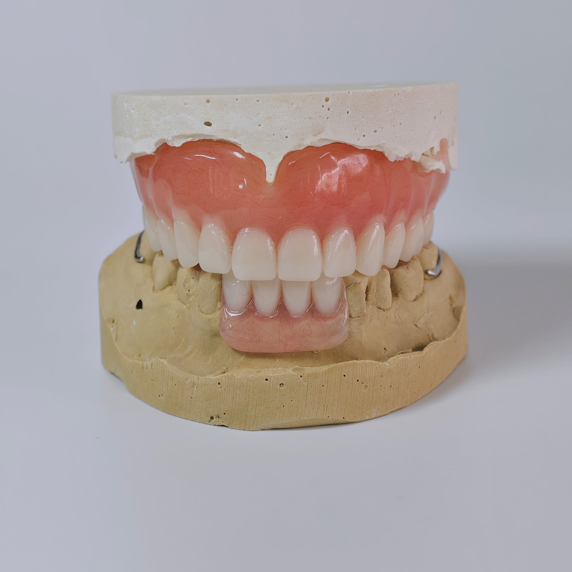 Full-Mouth Acrylic Denture