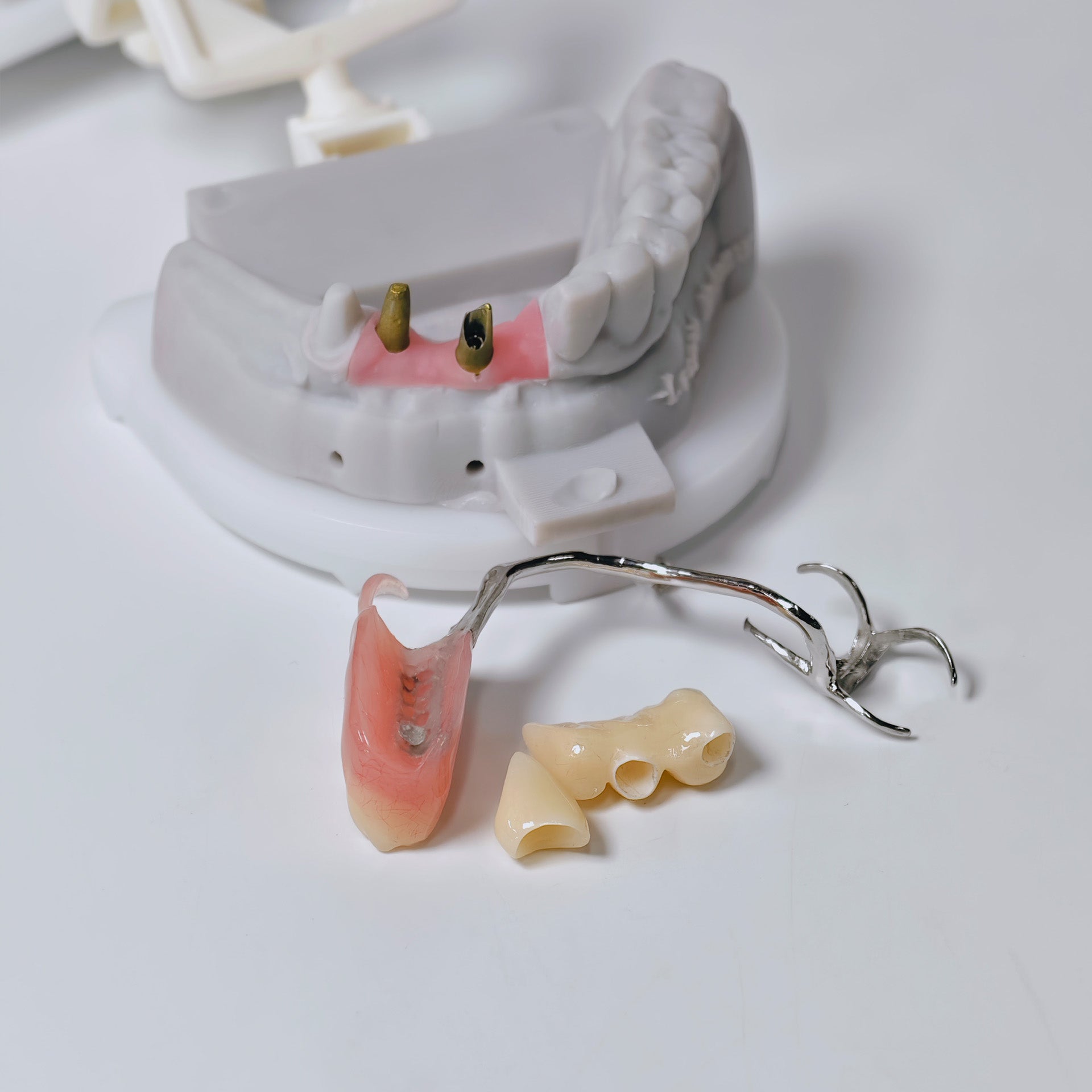 Full-Zirconia Crown And Bridge With Cement Retained And Co-Cr Frame Partial Denture