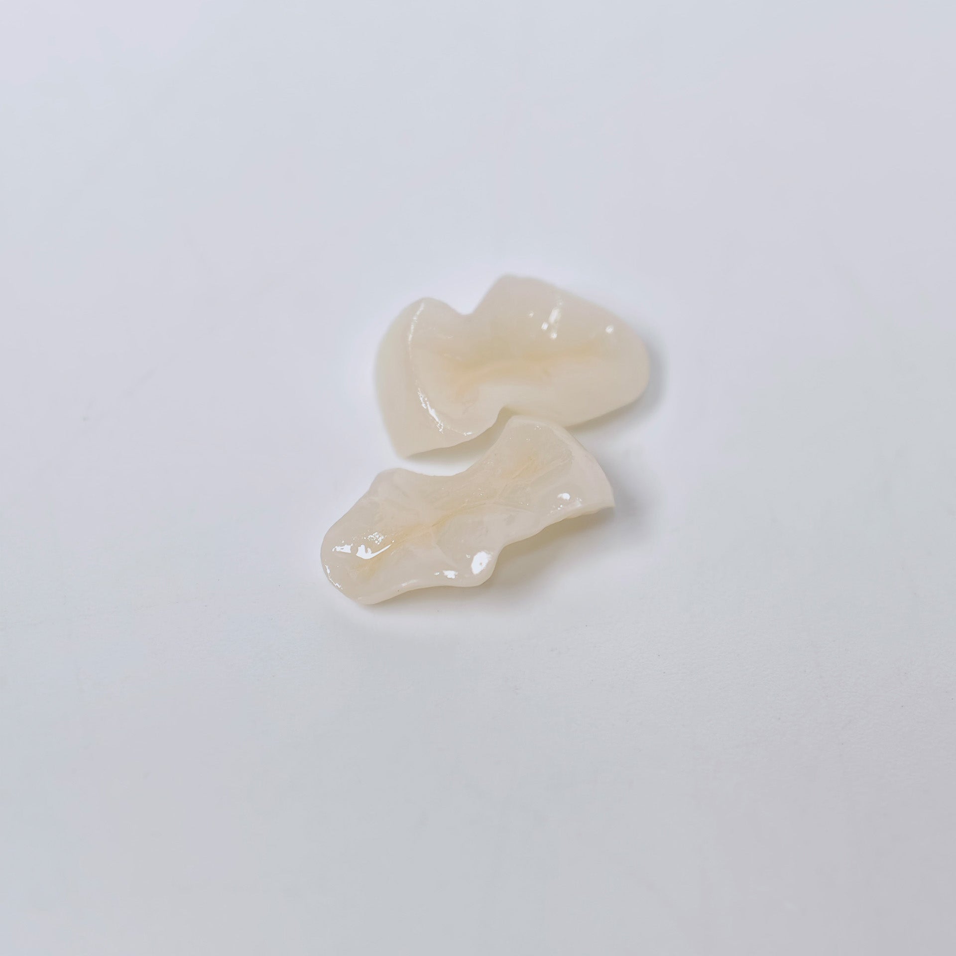 Full-Zirconia Laying With Cement-Retained