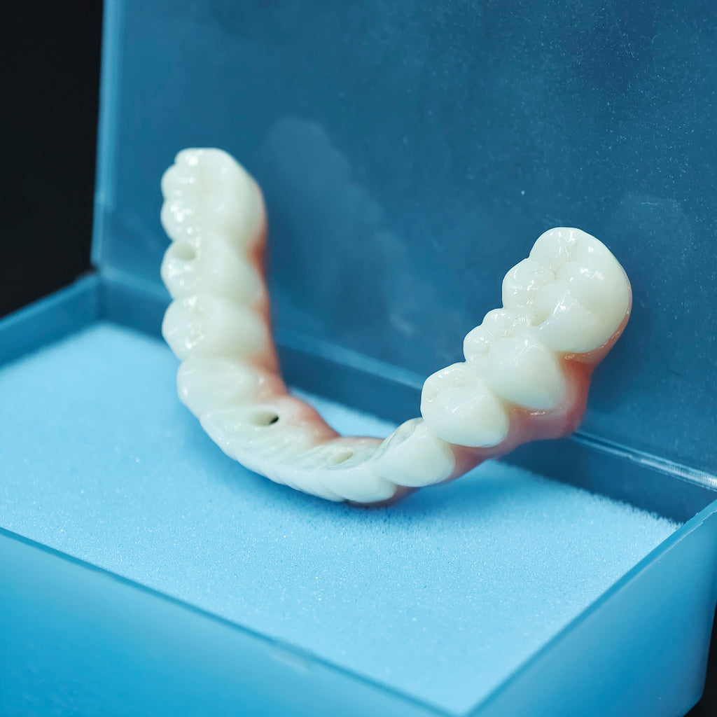 Zirconia Bridge With Ti-Base Abutment