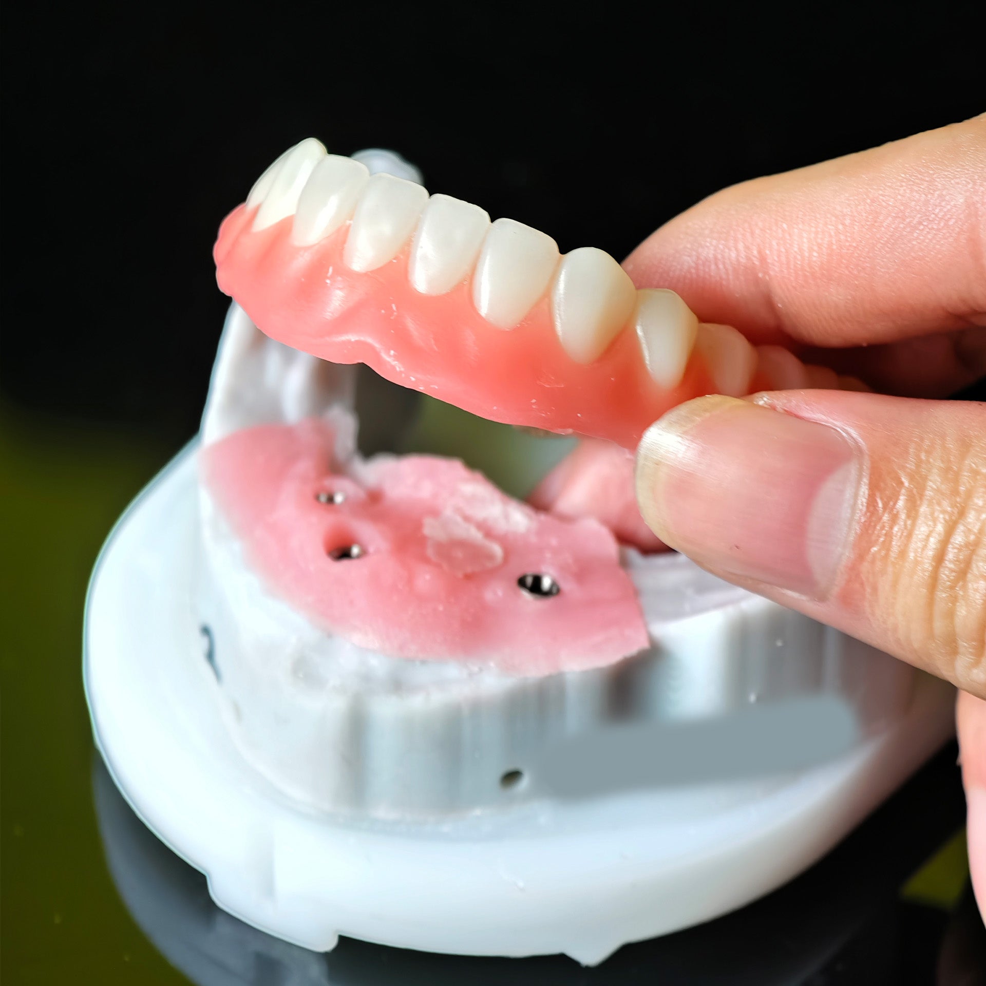 Acrylic Denture Resin Teeth Affordable Full Acrylic Denture